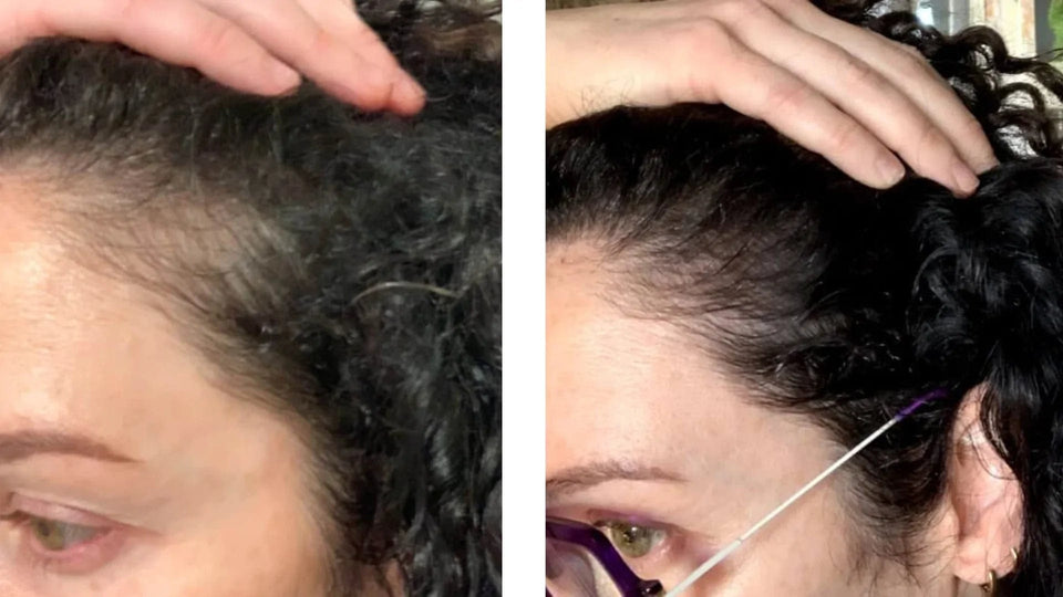 Pink Perfect Tratamento Biocompatível para Crescimento/Anti-Queda!