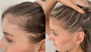 Pink Perfect Tratamento Biocompatível para Crescimento/Anti-Queda!